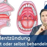 Mandelentzündung