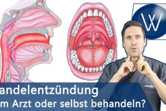 Mandelentzündung